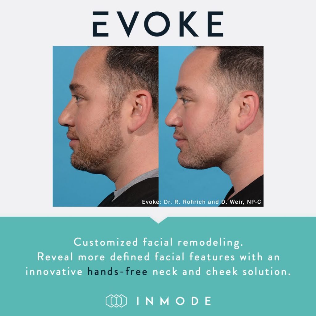 Evoke Non-Surgical Face and Neck Remodeling in Colorado Springs, CO