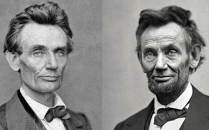 Dr. John Burroughs, Colorado Springs Cosmetic Surgeon, Discusses Facial Aging & Abraham Lincoln