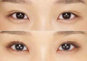 What Can Be Done to Make My Lashes Longer and Prettier? Dr. John Burroughs, Colorado Springs Eyelid Specialist, Answers.